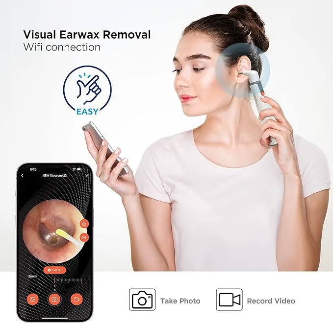 MOBI Smart Otoscope Ear Cleaning Accessory Kit for Use with MOBI Smart Wi-Fi Otoscope HD Camera (Item# 70676)