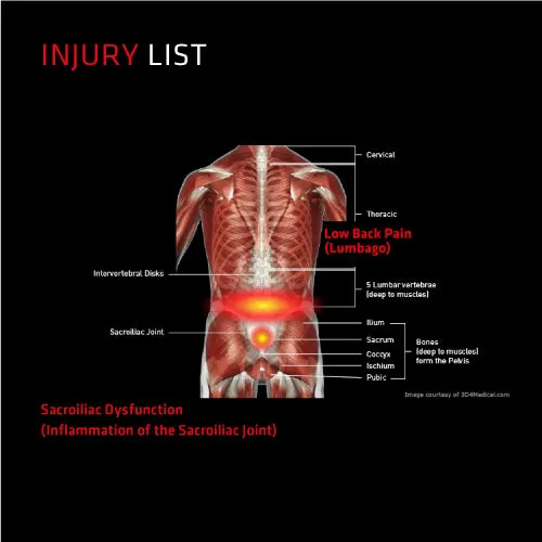 Thermoskin Sacroiliac Support Belt (1 Unit)